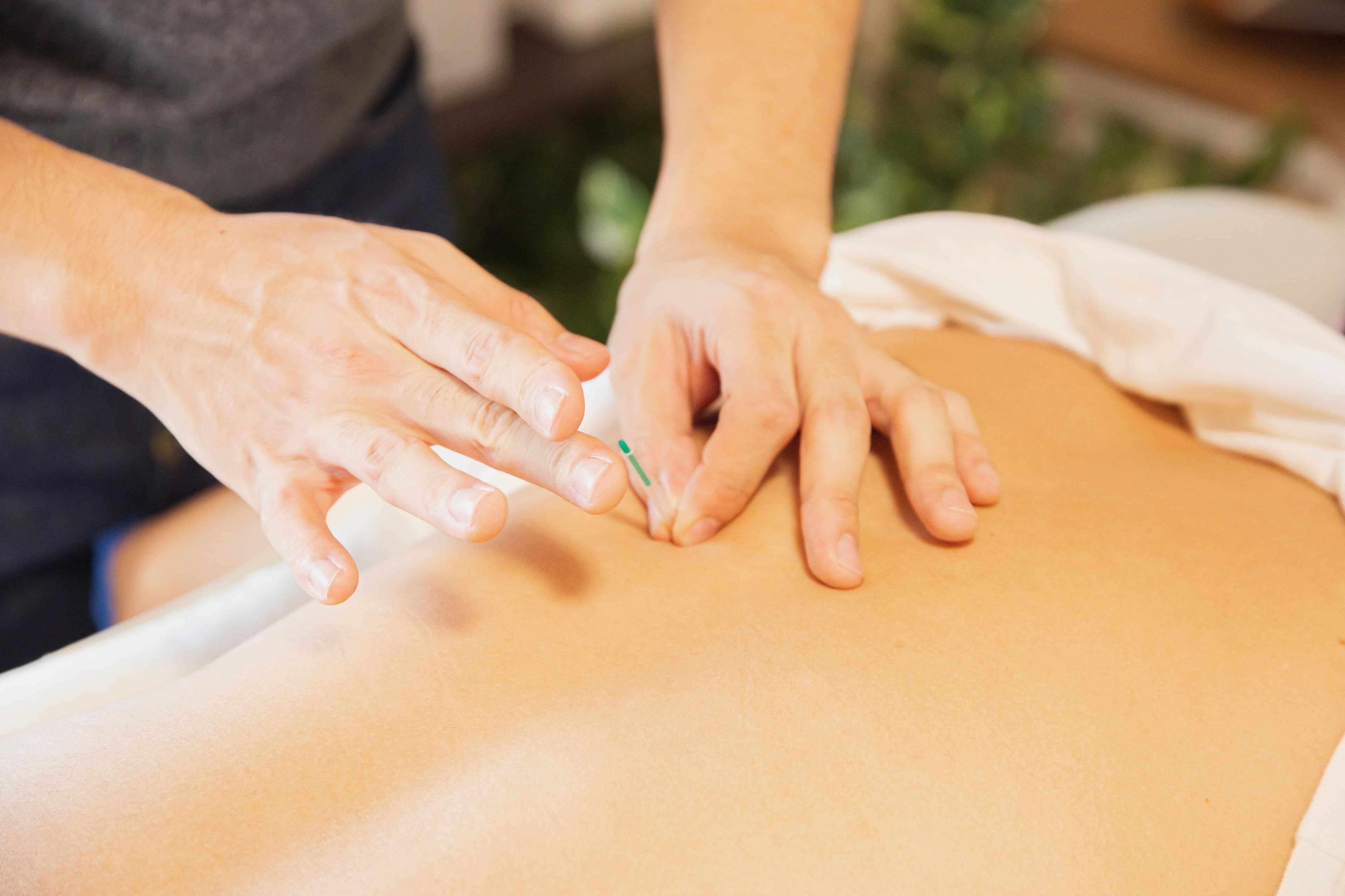 Professional medical acupuncture services in Davis County
