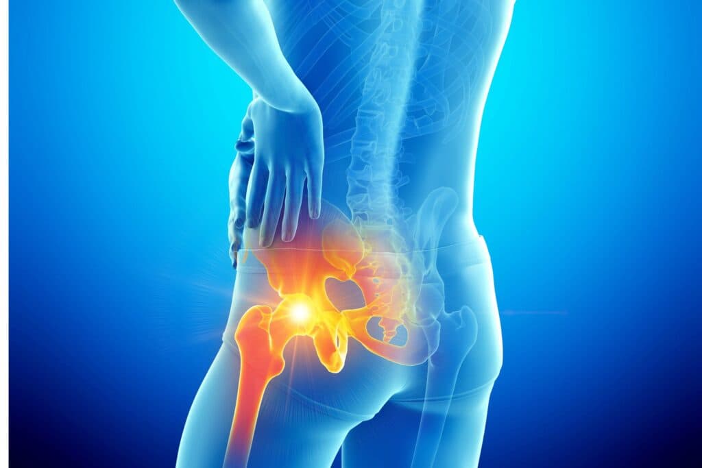 Hip Pain Therapy